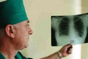 В Пензенской области будут исследовать туберкулез с множественной лекарственной устойчивостью