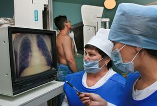 В 14 районах Пензенской области снизилась заболеваемость туберкулезом