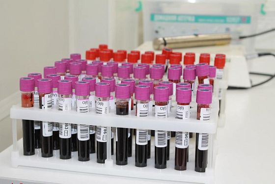 Более 17,5 тысяч литров донорской крови заготовили в Пензе за 2022 год