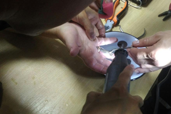 Пензенские спасатели помогли женщине снять кольцо с пальца