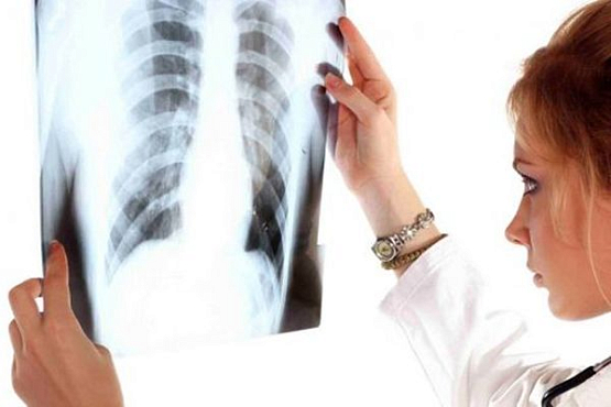 В Пензенской области уровень заболеваемости туберкулезом среди детей упал на 15%