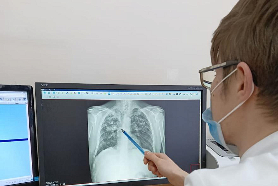 В Пензенской области за 2 месяца туберкулез выявили у 5 жителей 