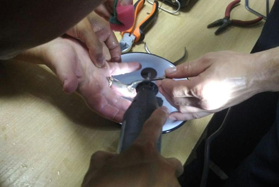 Пензенские спасатели сняли с пальца кольцо 7-летнему ребенку 