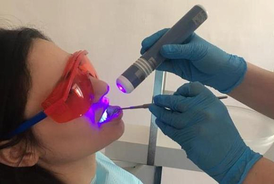 В Пензе стоматологи внедрили раннюю диагностику онкопатологии полости рта