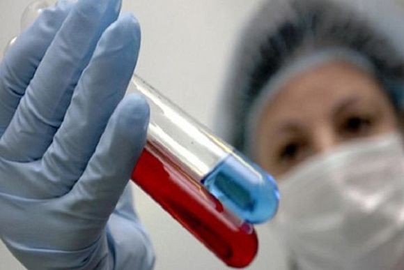 В Пензенской области лабораторно подтверждено 182 случая гриппа